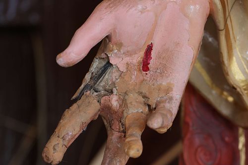 Closeup of the badly broken hand from the palm side.